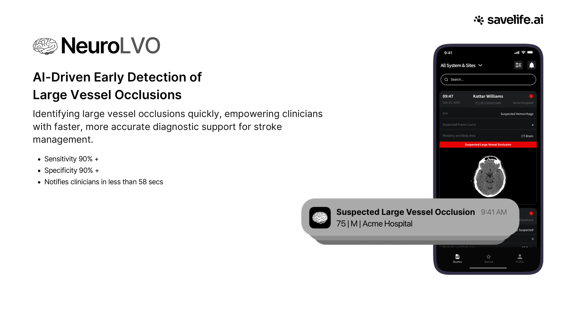 NeuroLVO, large vessel occlusion detection for stroke care