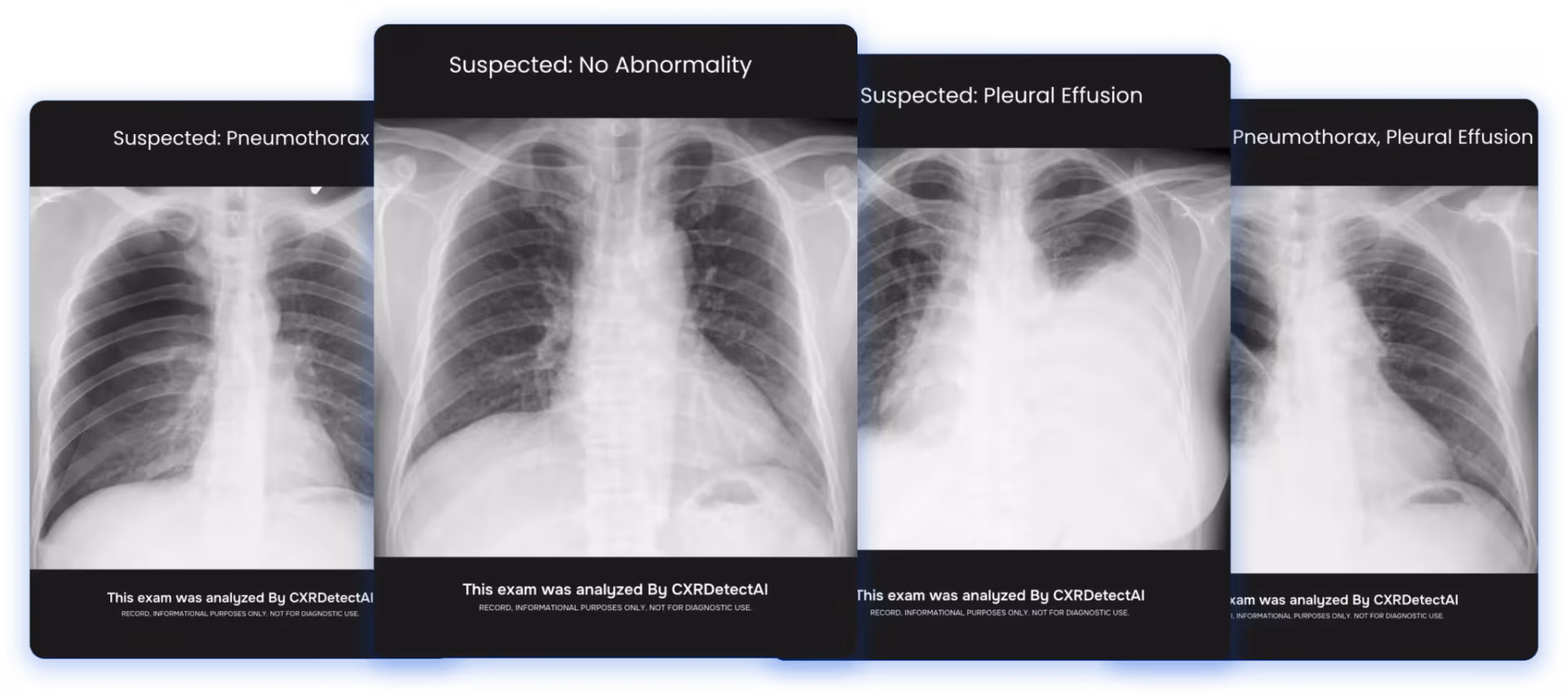 CXRDetectAI, FDA-cleared chest X-ray abnormality and TB detection