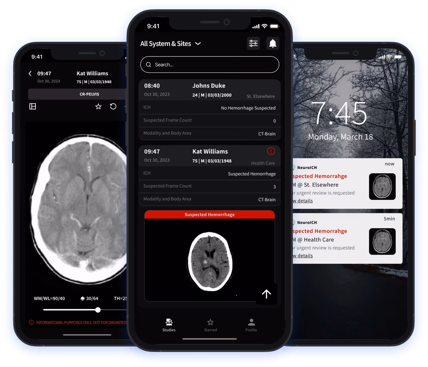 NeuroICH hemorrhage detection on a non-contrast head CT