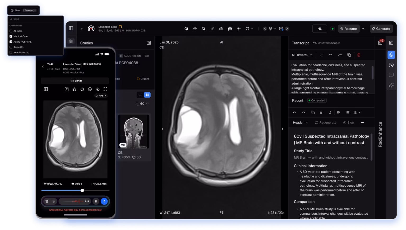RadioViewAI DICOM Viewer