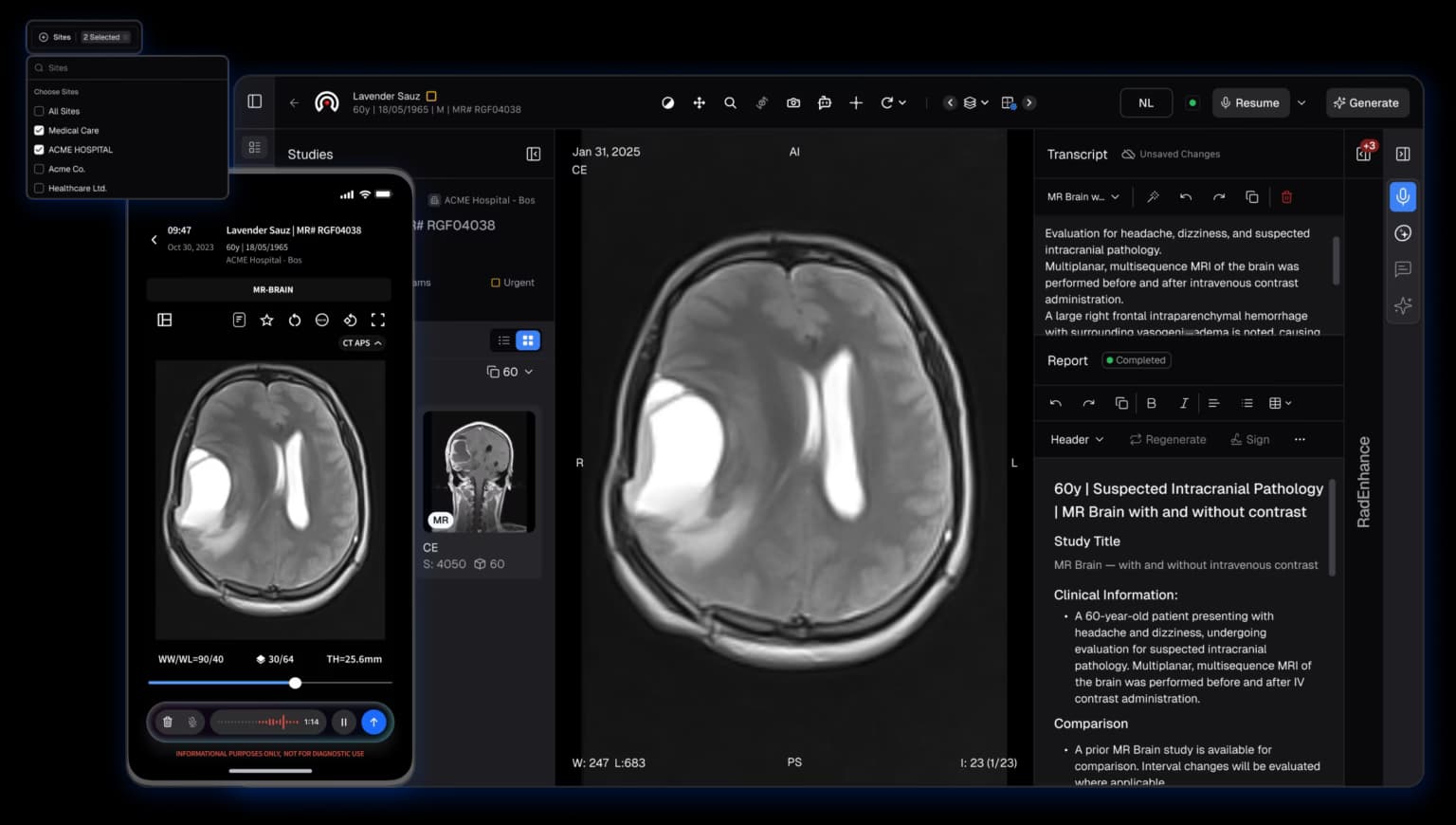 RadioViewAI DICOM Viewer