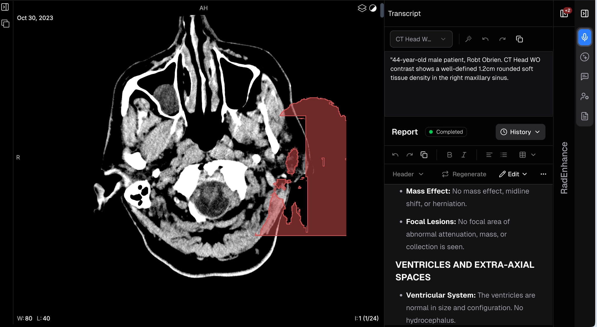 AI Measurements - added to report