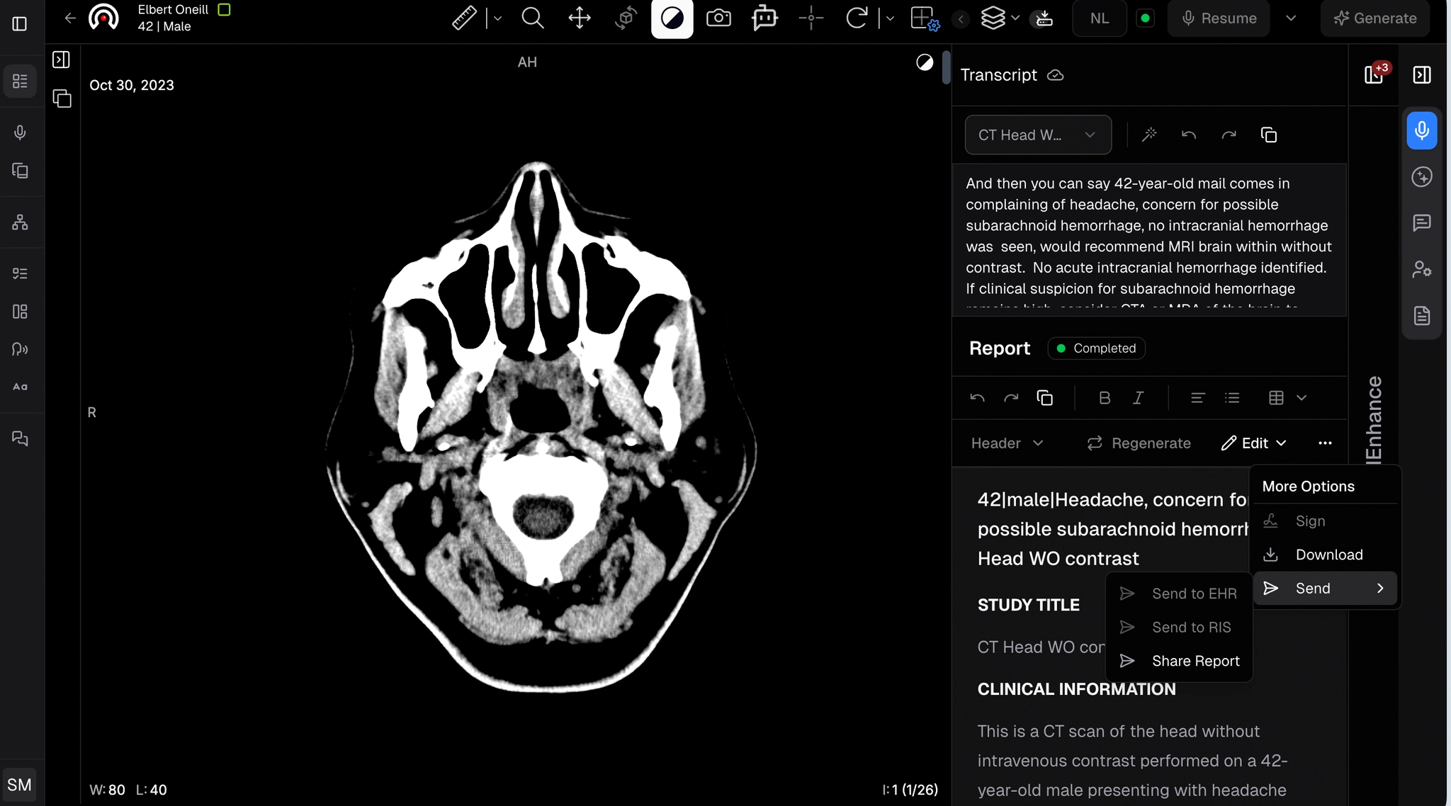 Send dropdown menu